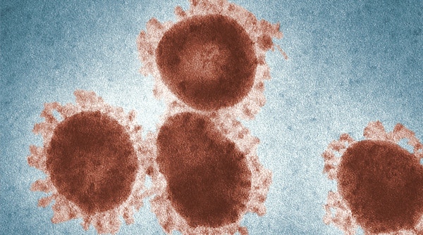 Virus microscope image