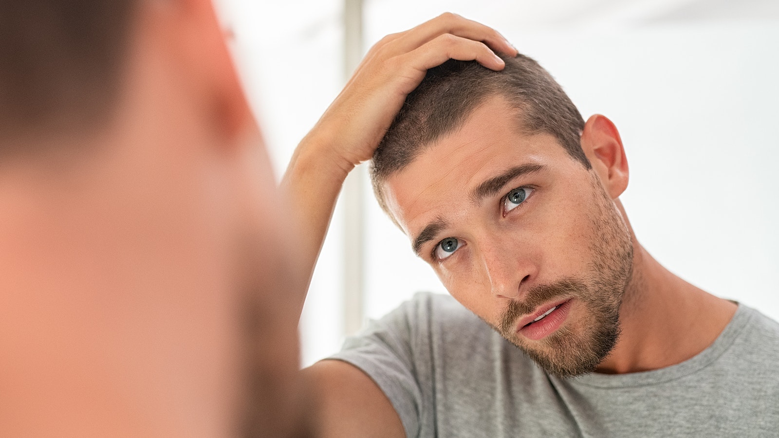 Addressing Hair Loss in the UK