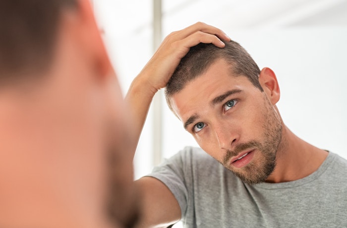 Addressing Hair Loss in the UK