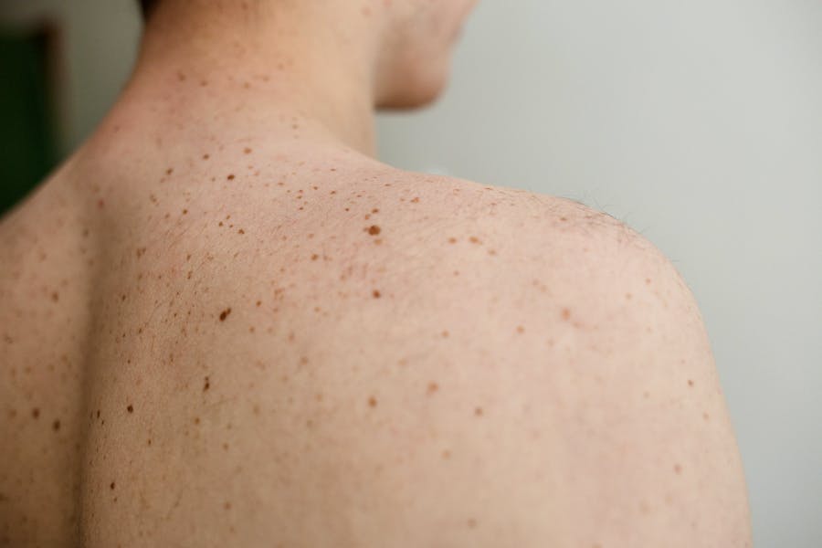 Bigstock-Close-Up-Detail-Of-The-Bare-Sk-261648634