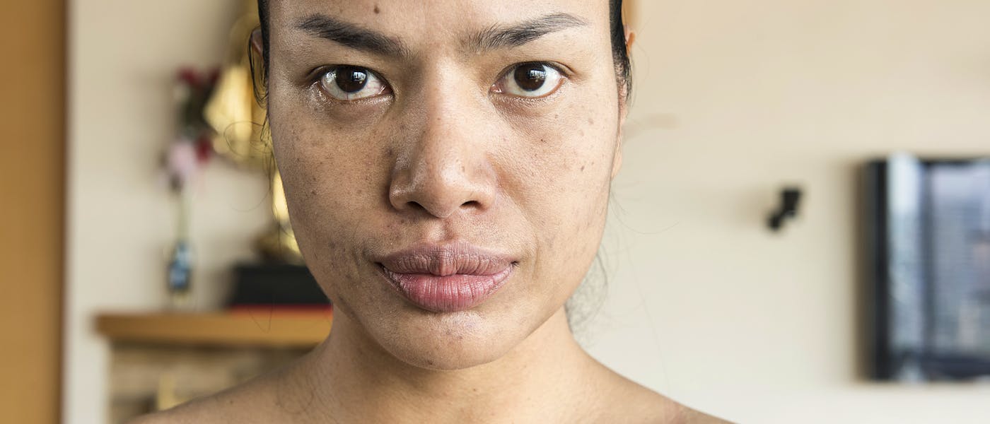 Calming Skincare Heroes For Sensitive Skin