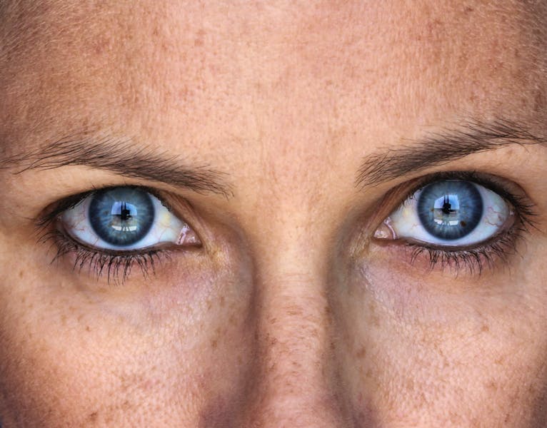Skincare Ingredients To Help With Dark Spots